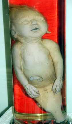 bébé-sirène